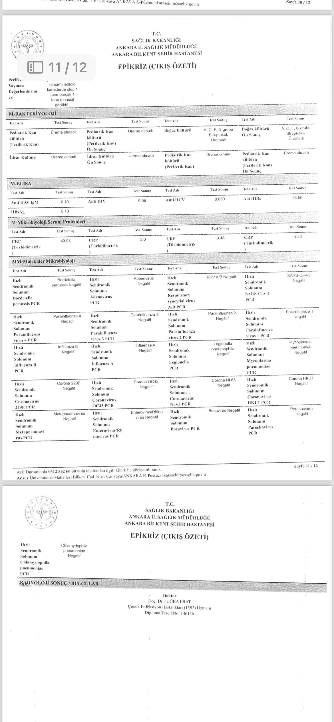 Test sonular