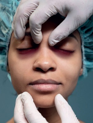 Medical Image Related to Brurest Gel
