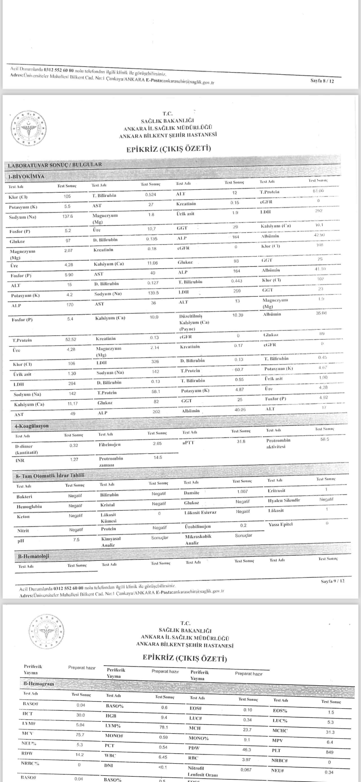 Test sonular